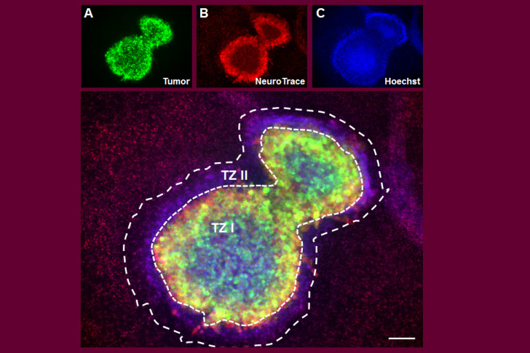 New model for vascular and tumor research