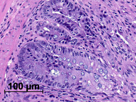 Towards entry "Minimizing risks of transplants"