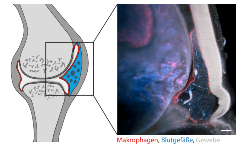 Towards entry "Inflammation in 3D"