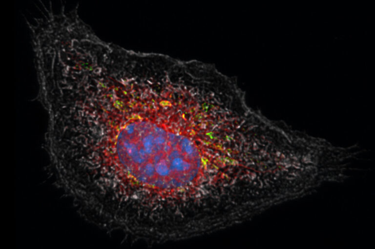 Study in Nature unlocks how cortisone inhibits inflammation